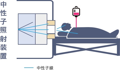 BNCTとは?
