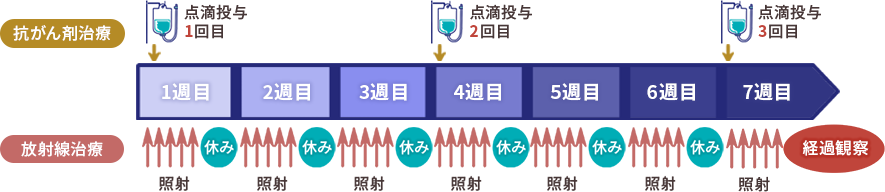 化学放射線療法 イメージ画像